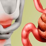 10 Cara Mengatasi Masalah Pencernaan