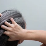 7 Cara Mengatasi Rambut Beruban Secara Alami
