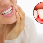 7 Tips Merawat Kesehatan Gusi agar Tidak Mudah Berdarah