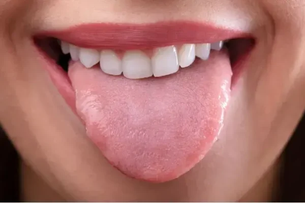 5 Tips Menjaga Lidah Tetap Lembap dan Sehat 5 Tips Menjaga Lidah Tetap Lembap dan Sehat