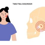 10 Cara Mengelola TMJ (Temporomandibular Joint Disorder) Secara Mandiri