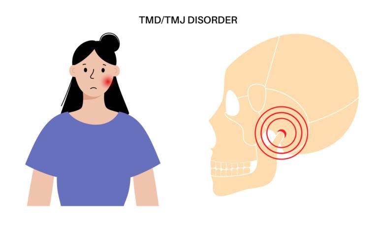 10 Cara Mengelola TMJ (Temporomandibular Joint Disorder) Secara Mandiri
